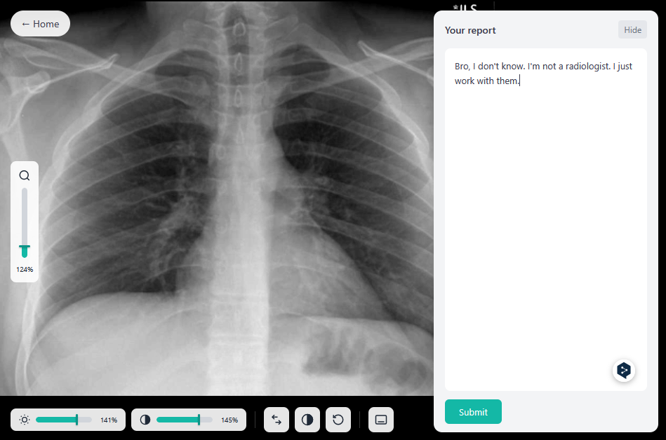 MedDaaS reporting interface showing a chest X-ray with brightness and contrast controls alongside a report text editor